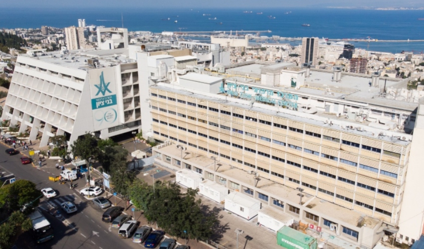 המרכז הרפואי בני ציון (צילום: תמיר אסרף)