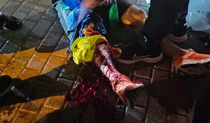 הפציעה של עידן שמולביץ' (צילום: יגאל שמולביץ')